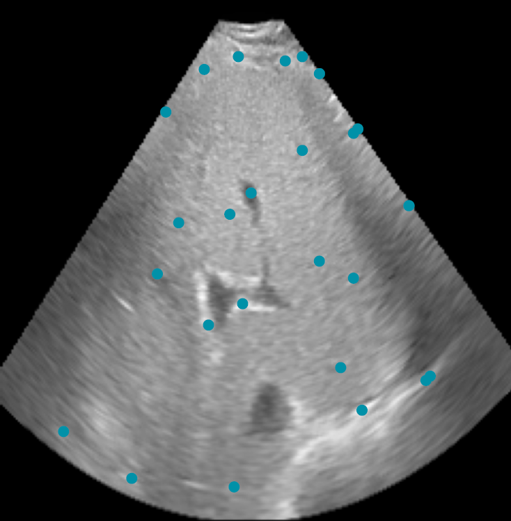 Ultrasound Image Analysis